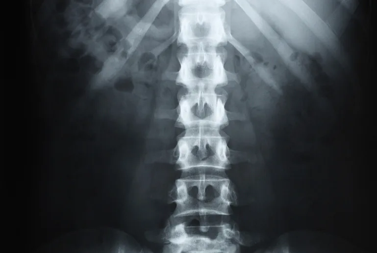 A lumbar spine X-ray — the clinical evidence behind hands-on chiropractic diagnosis